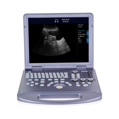 RC-BW360 Metal PC Platform Laptop Black And White Ultrasound Machine For Vet Surgery Use